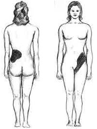 back pain kidney