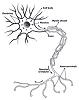 sciatica is caused by an irritation of the sciatic nerve