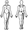 piriformis syndrome