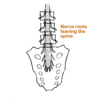 severe lower back pain