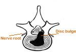 human spine anatomy diagram