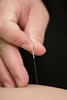 acupuncture